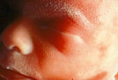 Face of a male foetus at 19 weeks