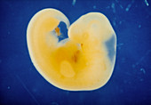 The human embryo at four weeks of gestation