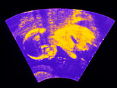 Ultrasound scan of a 15 week old human foetus