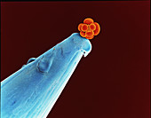 16-cell human embryo on a pin,SEM