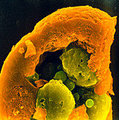 Coloured SEM of an aborting 6-8 cell embryo