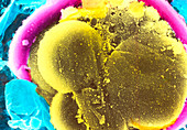 Coloured SEM of a 4-6 cell segmenting human embryo