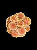 Coloured SEM of human embryo at 16-cell stage