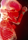 Twelve week old human foetus stained for skeleton