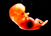Side view of a 12 week old foetus