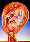 Artwork of 9 month old foetus in a cutaway uterus