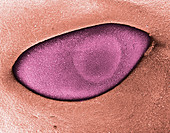 Coloured SEM of an eye of an 8 week old foetus