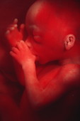 Face of 19 week old male foetus sucking his thumb