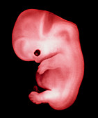 Coloured side view of a 44 day old human embryo