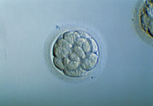 Morula embryo