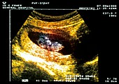 9 week foetus ultrasound