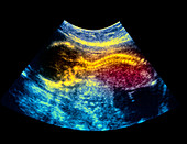 16 week foetus ultrasound