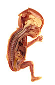 Sectioned foetus