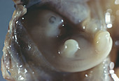 Six-week-old embryo
