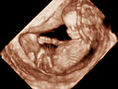 12 week foetus,3-D ultrasound scan