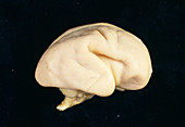 Foetal brain