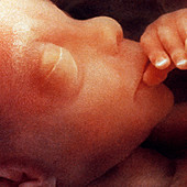 Foetus face aged 12 weeks