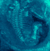 Foetus skeleton,ultrasound scan