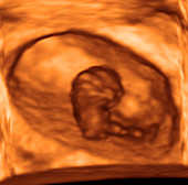 Foetus at 8 weeks,3-D ultrasound scan
