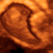 Embryo at 6 weeks,3-D ultrasound scan