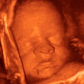 29 week foetus,3-D ultrasound scan