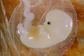 Human embryo,5 weeks old