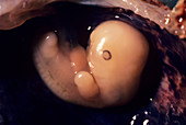 Embryo at six weeks