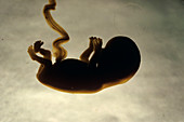 Foetus at 12 weeks