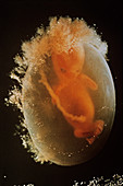 Foetus at nine weeks
