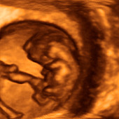 9 week foetus,3-D ultrasound scan