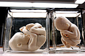 Foetuses at 18 weeks