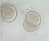 2-cell embryos,light micrograph