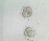 4-cell embryos,light micrograph