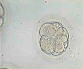 Multi-celled embryo,light micrograph