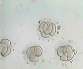 Multi-celled embryos,light micrograph