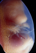 View of a 15.5 day old foetus of a rat