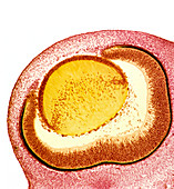Developing pig eye,light micrograph