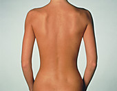 Posterior view of the torso of a standing woman