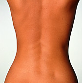 Woman's back: posterior view of the torso
