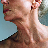 Woman's neck