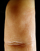Close-up of the skin of the index finger