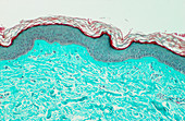 LM of a section through normal human skin