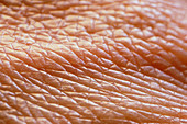 Skin surface