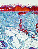 LM of section of skin from palm of hand