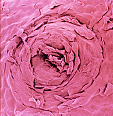 False col. SEM of a sweat pore on human scalp