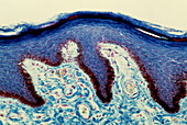 Sectioned black skin,light micrograph