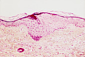 Light micrograph of section through human skin