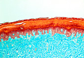 LM of a section through human skin