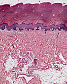 Sole skin,light micrograph