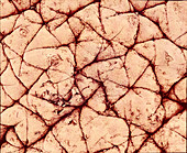 Human skin surface,SEM